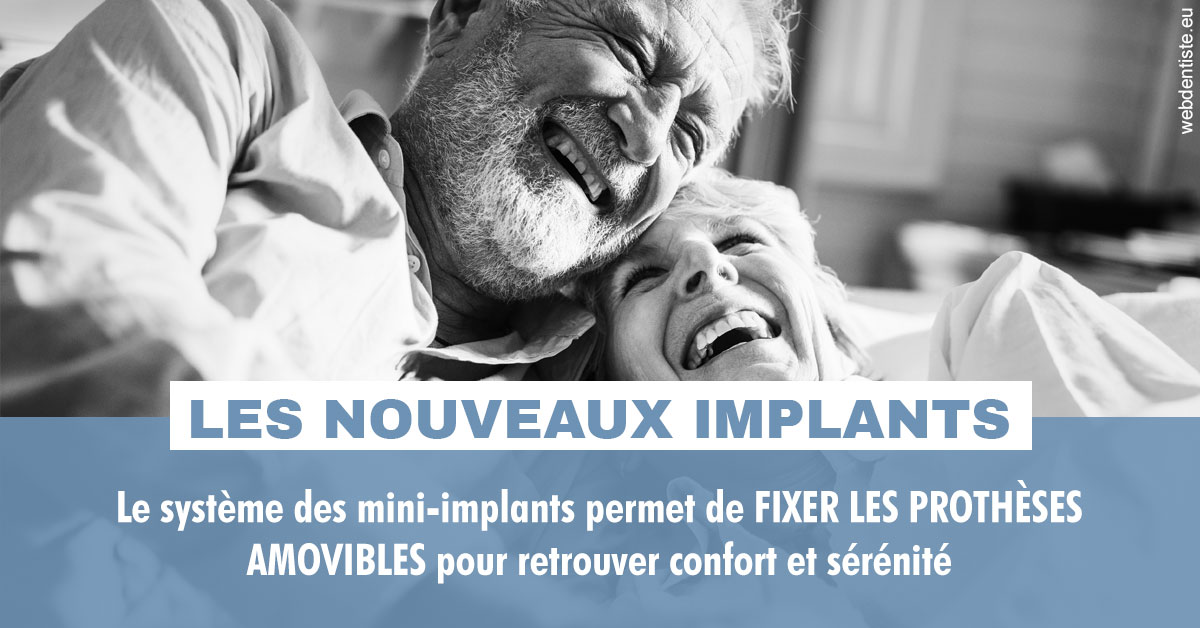 https://dr-mauro-fabien.chirurgiens-dentistes.fr/Les nouveaux implants 2
