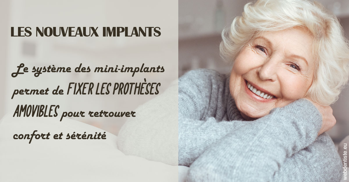 https://dr-mauro-fabien.chirurgiens-dentistes.fr/Les nouveaux implants 1