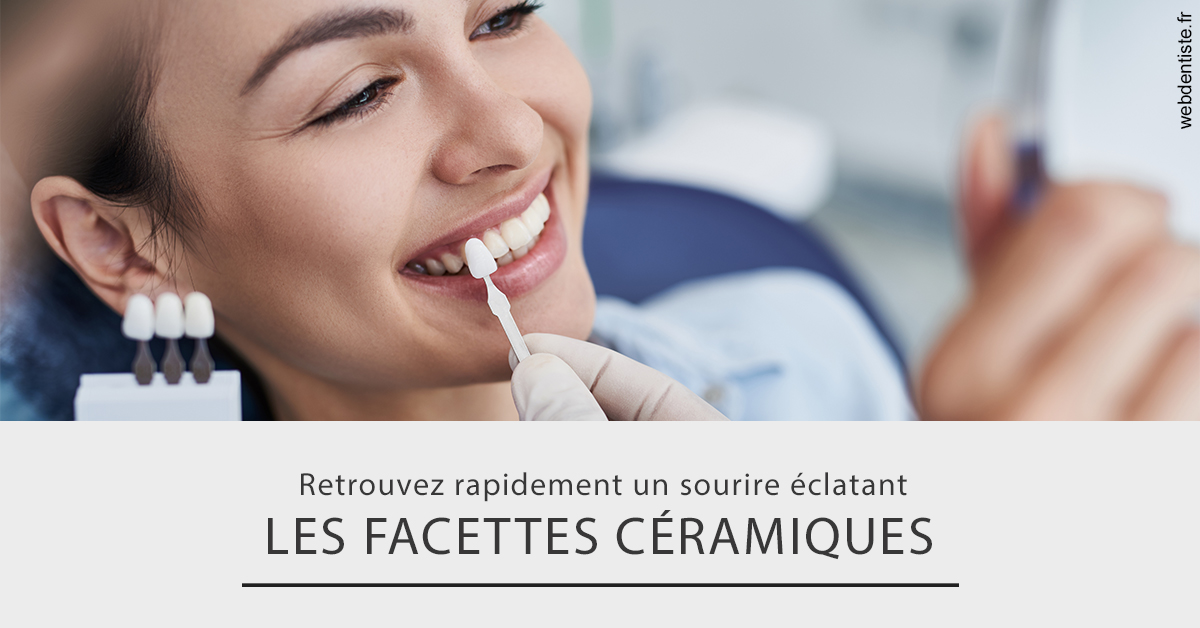 https://dr-mauro-fabien.chirurgiens-dentistes.fr/Les facettes céramiques 2