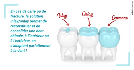 https://dr-mauro-fabien.chirurgiens-dentistes.fr/L'INLAY ou l'ONLAY