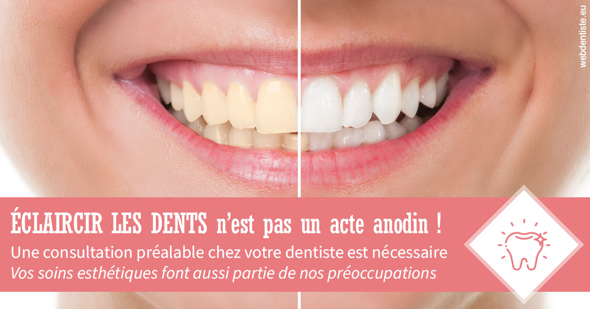 https://dr-mauro-fabien.chirurgiens-dentistes.fr/Eclaircir les dents 1