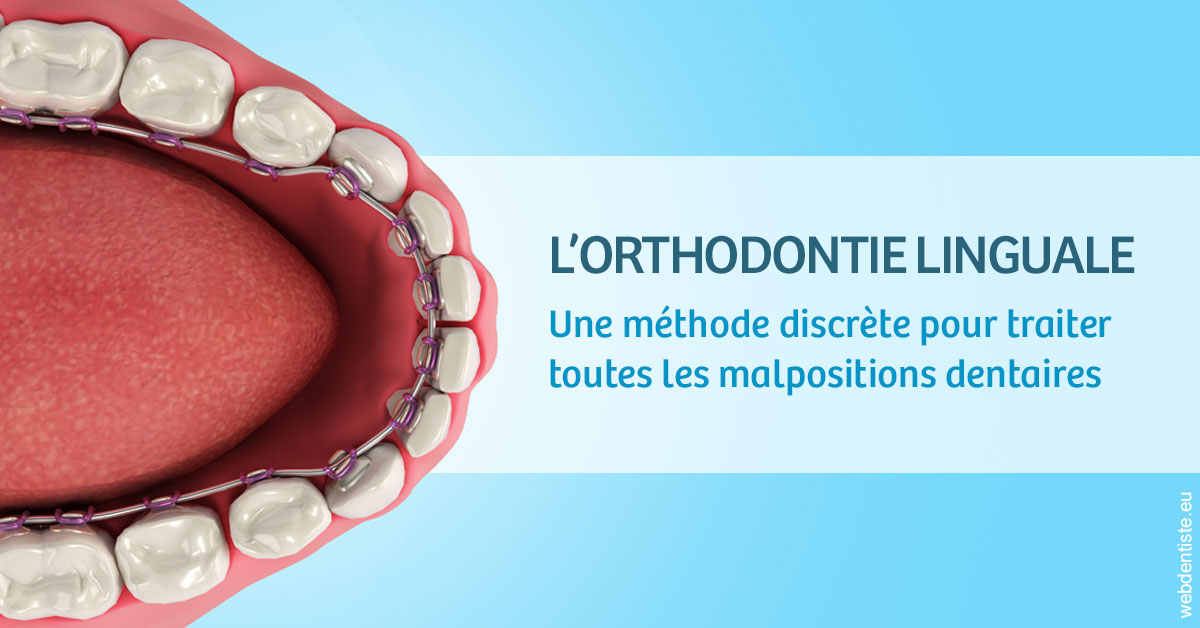 https://dr-mauro-fabien.chirurgiens-dentistes.fr/L'orthodontie linguale 1