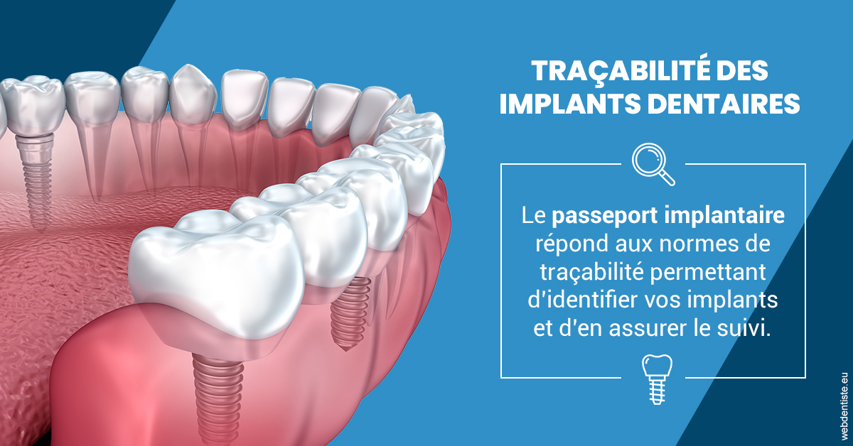 https://dr-mauro-fabien.chirurgiens-dentistes.fr/T2 2023 - Traçabilité des implants 1