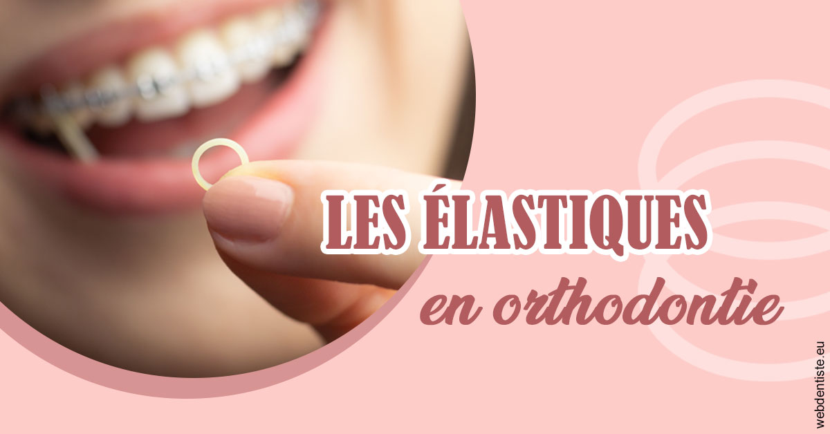 https://dr-mauro-fabien.chirurgiens-dentistes.fr/Elastiques orthodontie 1