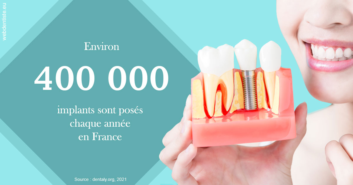 https://dr-mauro-fabien.chirurgiens-dentistes.fr/Pose d'implants en France 2