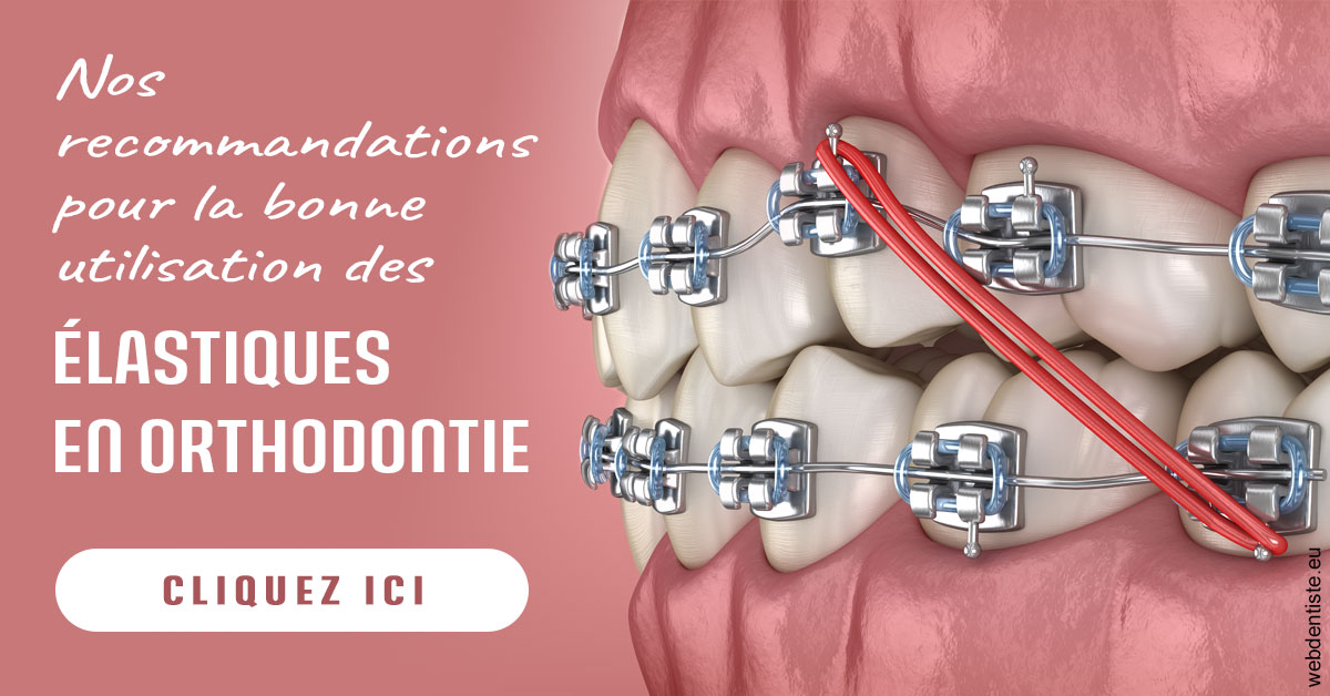 https://dr-mauro-fabien.chirurgiens-dentistes.fr/Elastiques orthodontie 2
